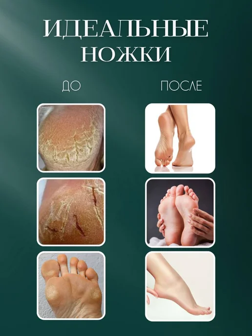CMGF Педикюрный нож скребок для пяток профессиональный, оранжевый, фото 2