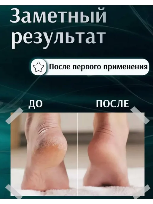 Терки для ног, вариант, фото 5