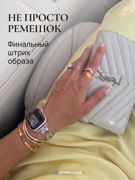 Hypno Case Ремешок для Apple Watch 38 40 41 серия 1-5 6 7 8 9 10 11 SE, желтый, фото 3