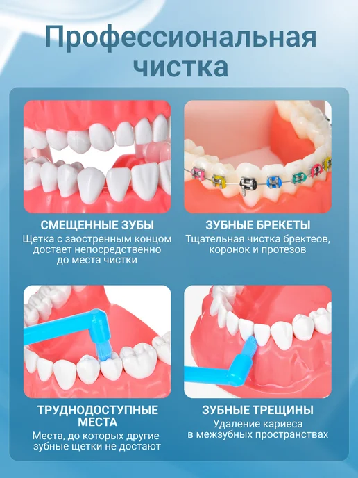 cherdi Монопучковая зубная щетка для брекетов, голубой, фото 2