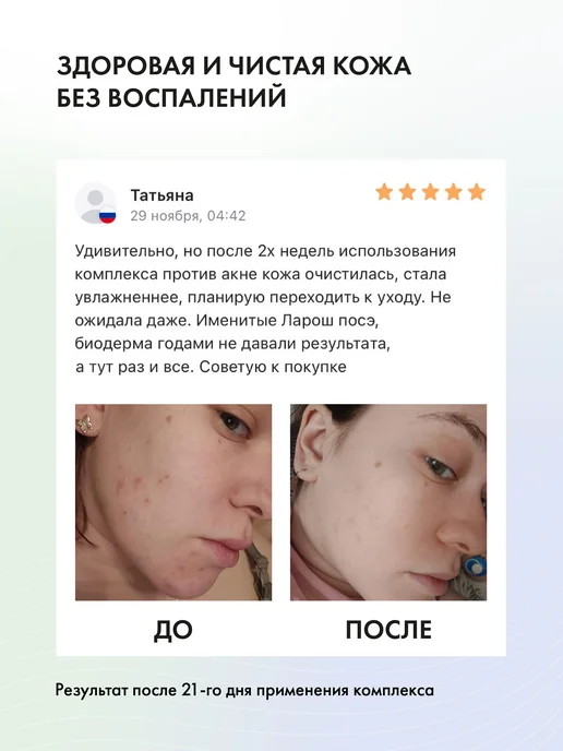 БьютиЦевтика Подарочный набор Акневицид от прыщей и акне, белый, фото 4