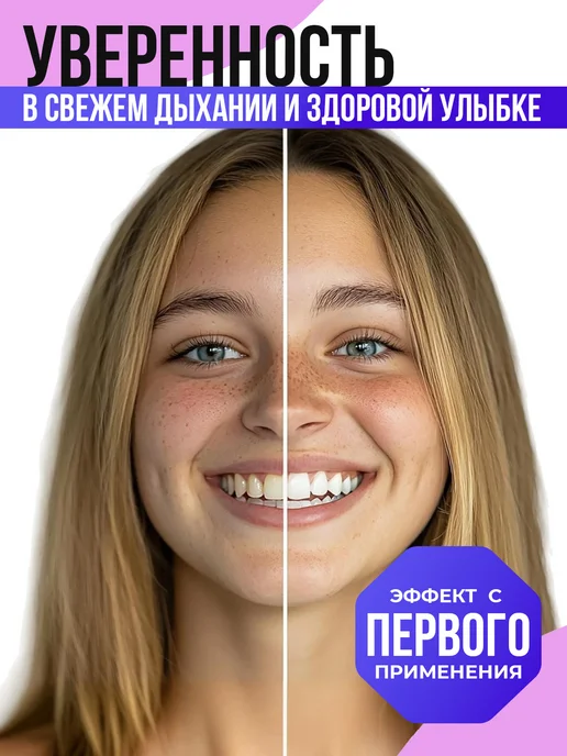 PROFILAX Зубная паста набор 4 вида по 100 гр, 100 г, фото 4